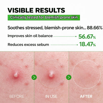✨🌿 Invisible Ultra-Thin Pimple Patches for Face – 0.013mm Clear Acne & Zit Stickers Under Makeup with Sulfur, Salicylic Acid, AHA & PHA, Korean Skincare, 72 Count